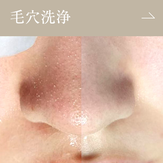 毛穴洗浄