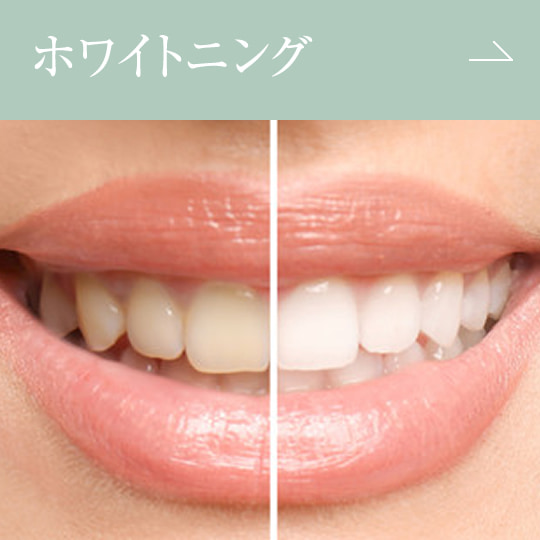 ホワイトニング